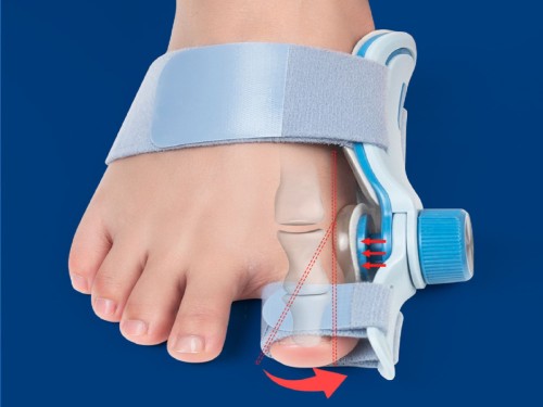 Bunion Corrector